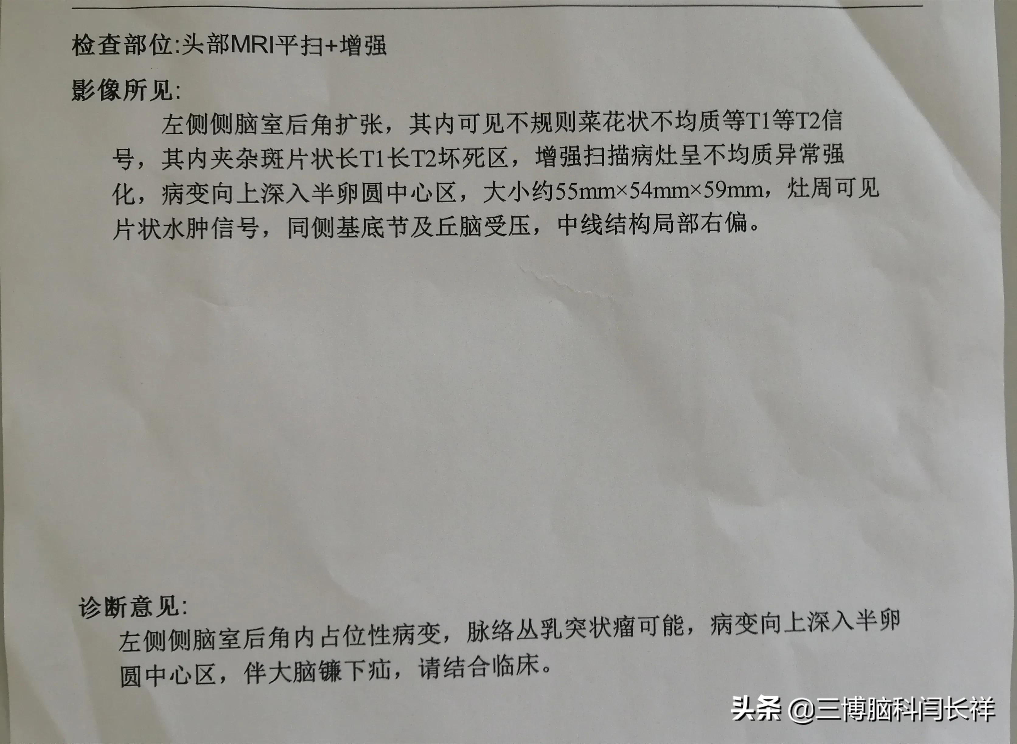 福大命大躲过了火车脱轨,却还是栽在了脑肿瘤上