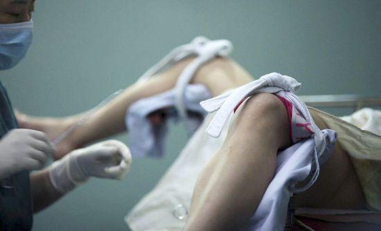 会阴体短的症状及缓减治疗