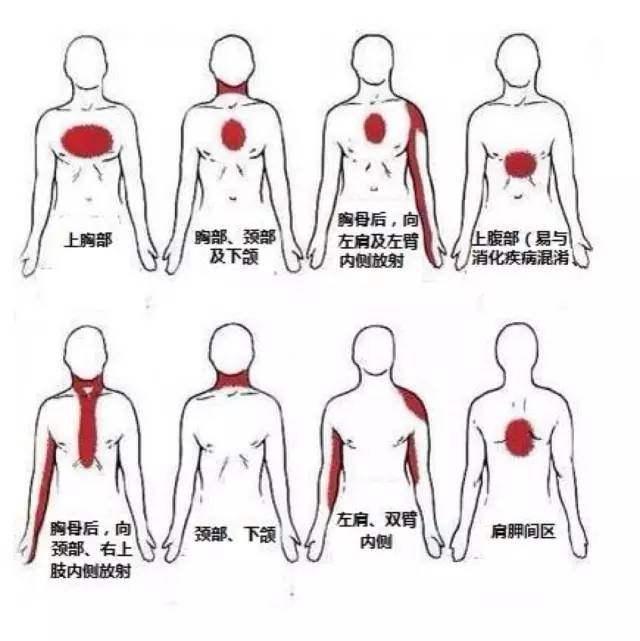 胸前区不舒服用了硝酸甘油不但没缓解还差点丢了命什么原因