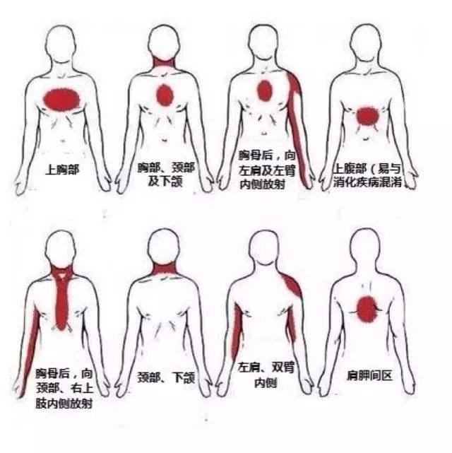 胸前区位置图片