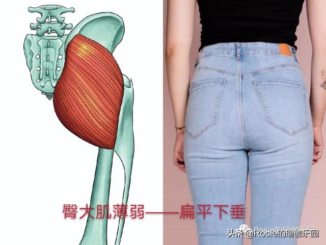 翘臀还有假先自测再确认你是真翘臀还是骨盆前倾