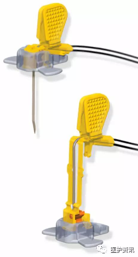 输液港安全型无损伤针静脉输液及维护操作运城市第一医院肿瘤微创及