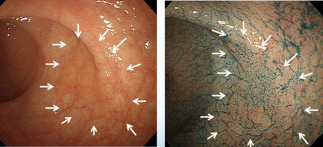 关于癌症，这三点你一定要知道！