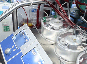 重庆市璧山区人民医院完成全区首例体外循环直视下心脏手术