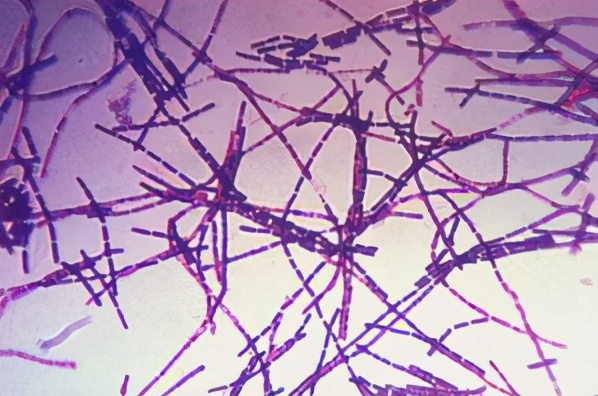 革兰染色阳性菌图片
